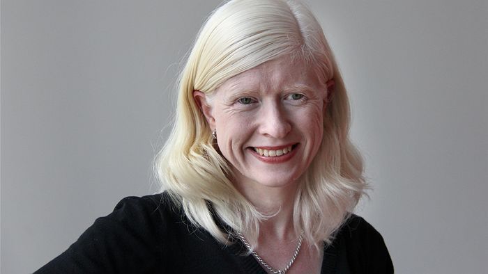 Dr Shari Parker shares what being albino really means episode artwork