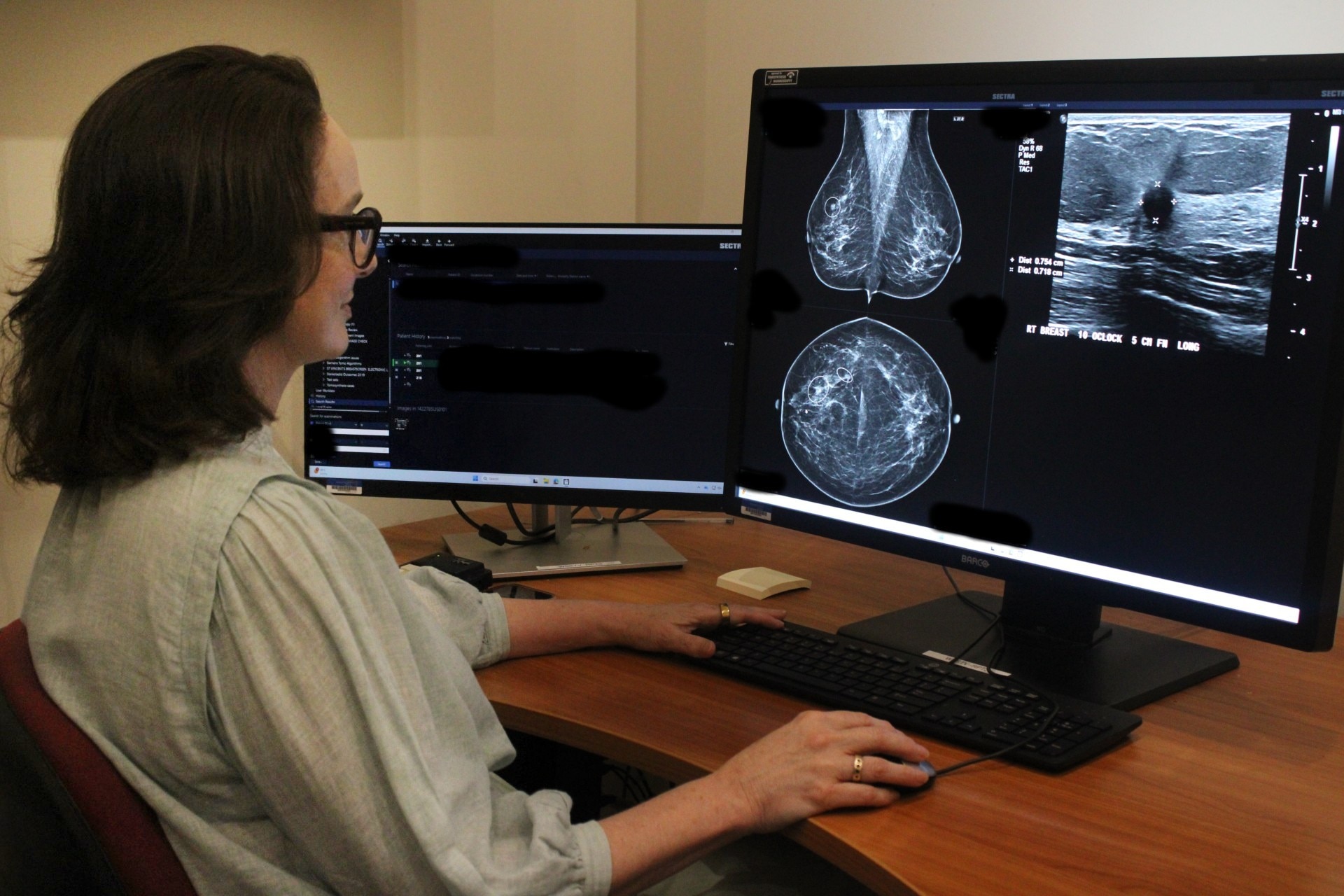 abc.net.au - Paige Cockburn - Australian-made AI detects breast cancer risk previously missed: study