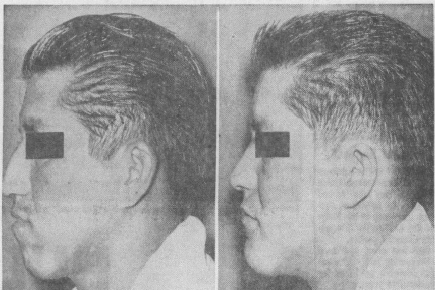 News article with man's before and after side profile and: 'Convicts receive plastic surgery for improvements inside and out' 