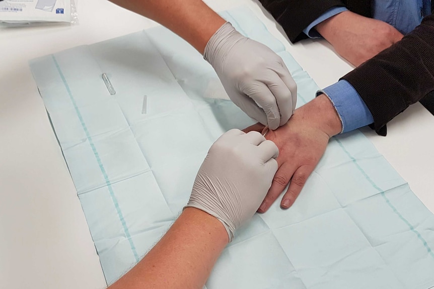 An office worker getting a chip implanted