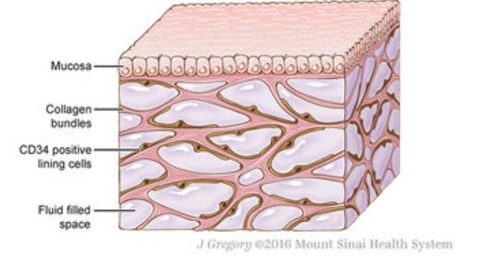 Illustration of a pink cube showing top layer of skin and collagen bundles underneath it.