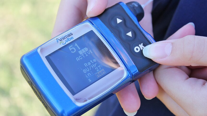 An insulin pump used in the management of diabetes.