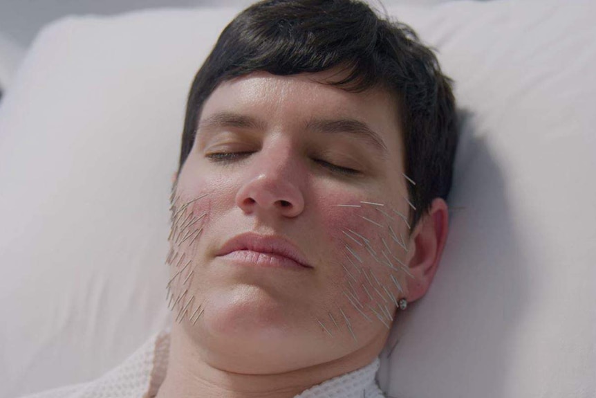 Close of Elise Loehnen's face with 100 needles inserted into, in the name of facial acupuncture.