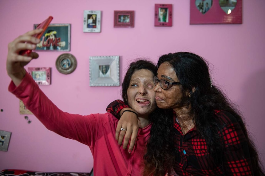 Two women with burned faces pose for a selfie