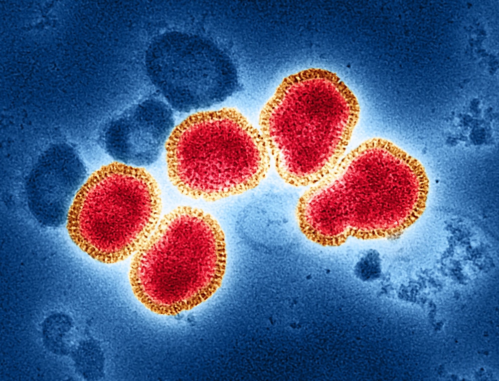 Microscope image of a round red-coloured virus against a blue background.