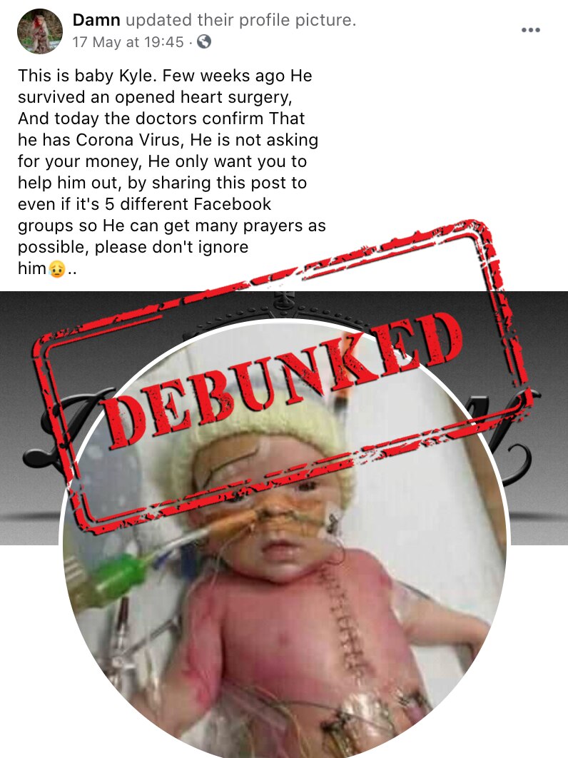 Facebook post with a photo of a baby which has had surgery with a large debunked stamp on top