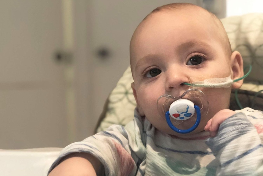 Seven-month-old baby boy with tube into nose and dummy