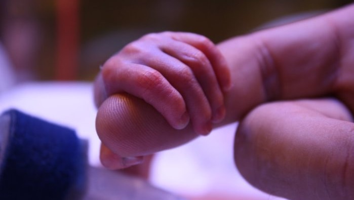 A premature baby's hand grips an adult finger. It barely stretches the width of two knuckles.