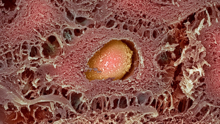 Coloured scanning electron micrograph of a skin cell.