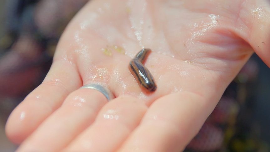 How do leeches bite without you even knowing? - ABC listen