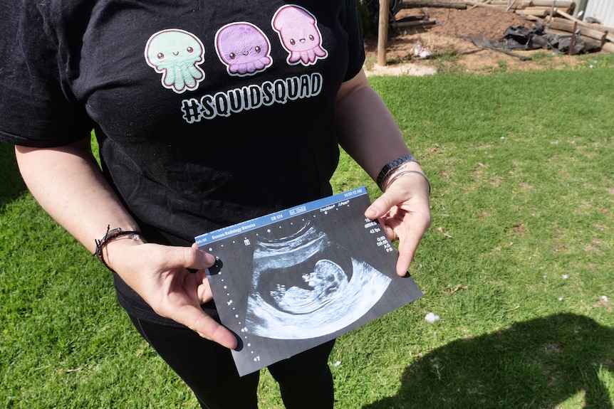 A woman wears a black shirt with squid reading 'Squid Squad' she holds a black and white baby ultrasound over her belly