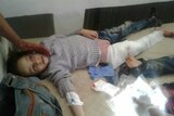 A young girl lies on a hospital bed with a bandaged leg and blood.