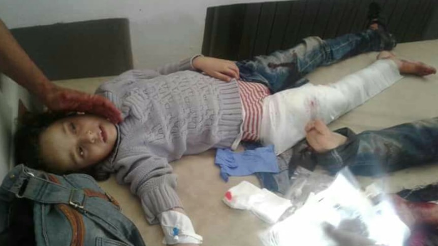 A young girl lies on a hospital bed with a bandaged leg and blood.