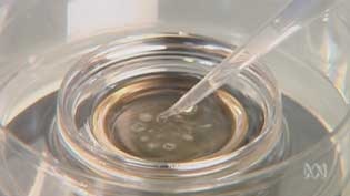 Discovery hailed: The cells are recovered from the fluid that surrounds the baby in the womb (file photo).