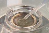 Stem cell researchers say they have developed an acceptable alternative to destroying embryos [File photo].