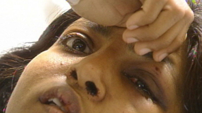 Assault victim Vaisaali.