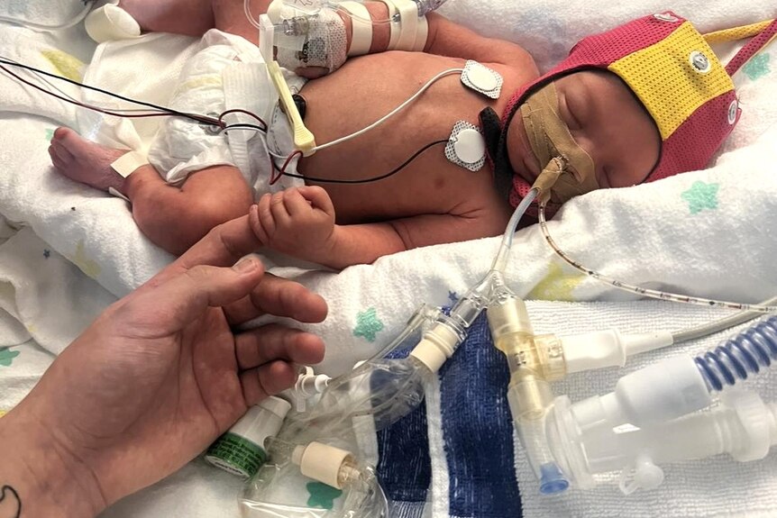 A small baby in an incubator connected to tubes and their hand clutched around someones finger. 