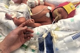 A small baby in an incubator connected to tubes and their hand clutched around someones finger. 