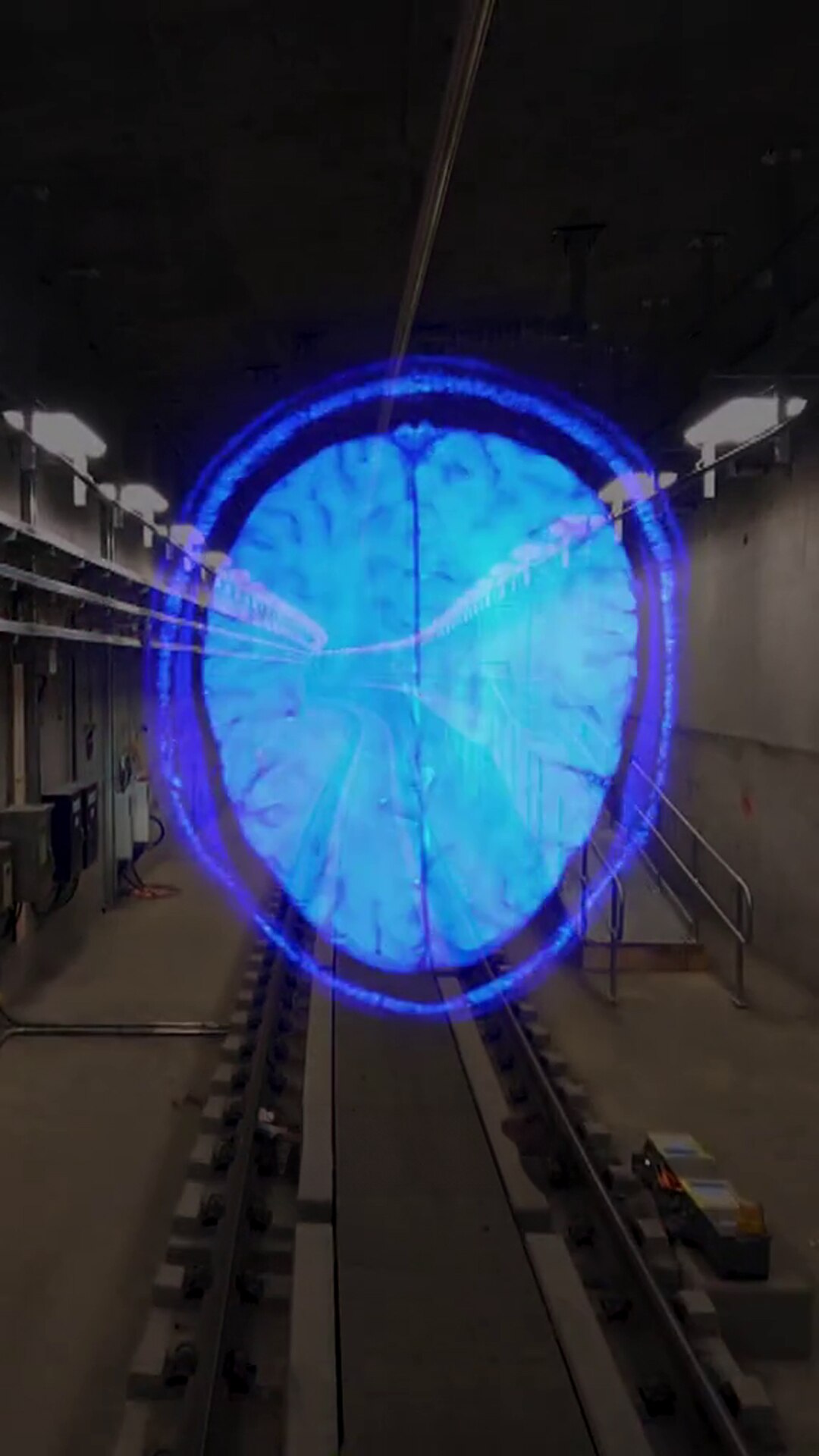 Why Metro trains are messing with MRI machines - ABC News