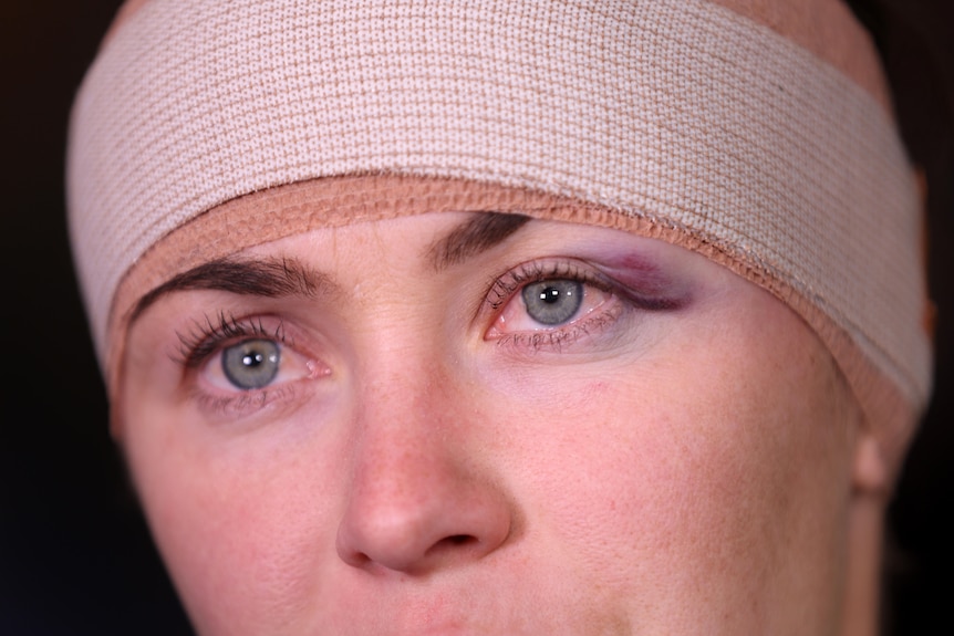 A woman with bandages wrapped around her head and a bruised eye