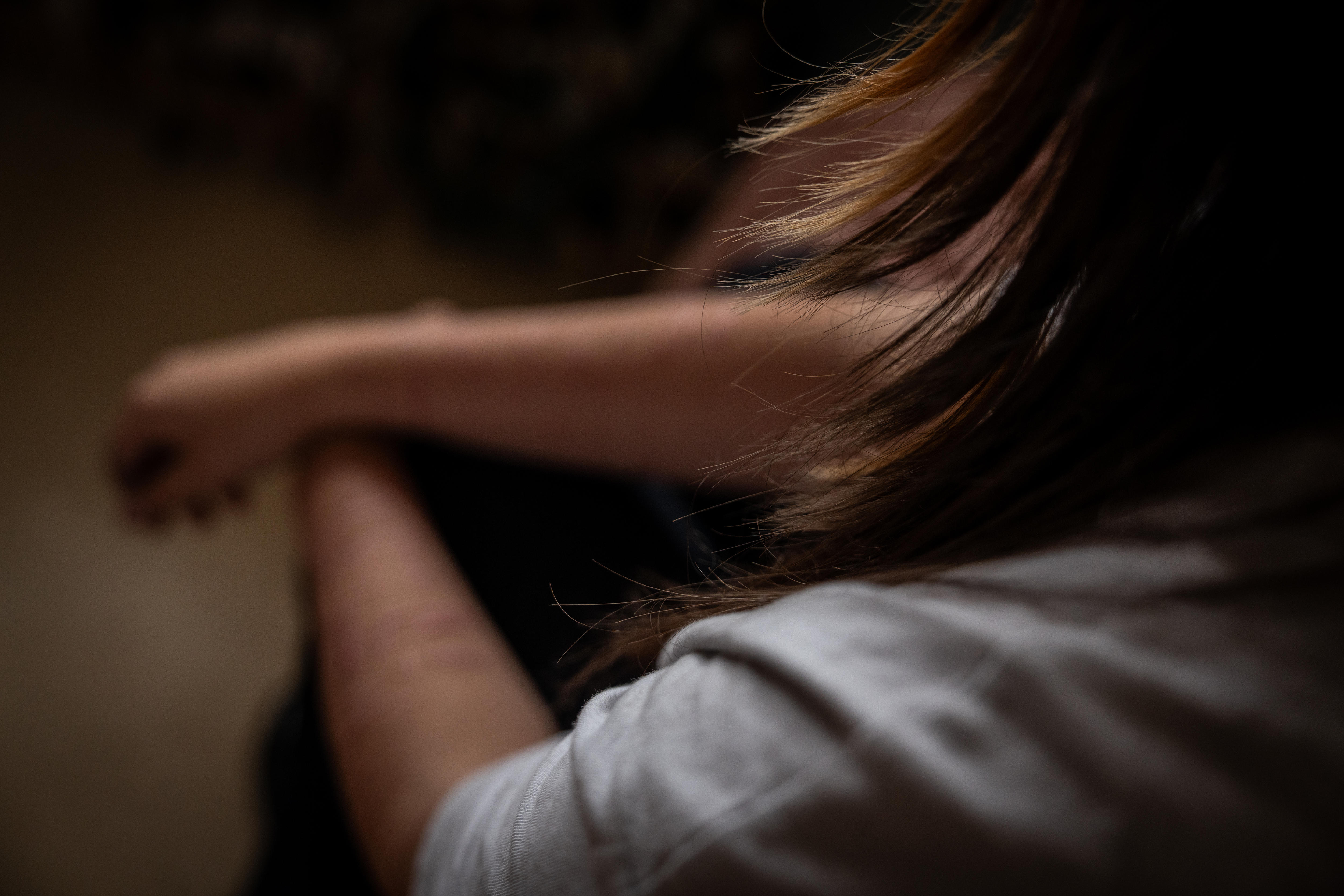 A teenage girls arms, blurred from scarring.