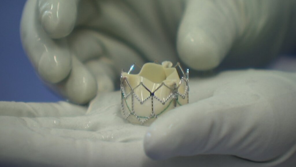 Surgeons issue warning over government policy on revolutionary keyhole