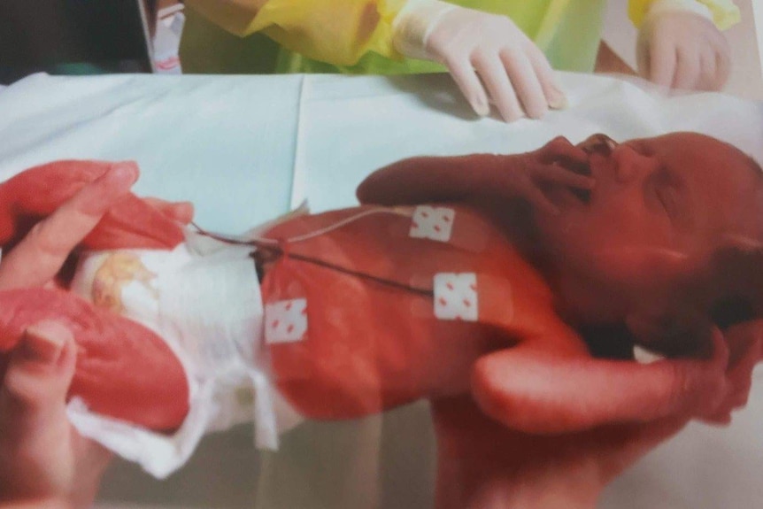A baby born at 32 weeks is watched over by its parents and doctors in a Neonatal Intensive Care Unit bed.