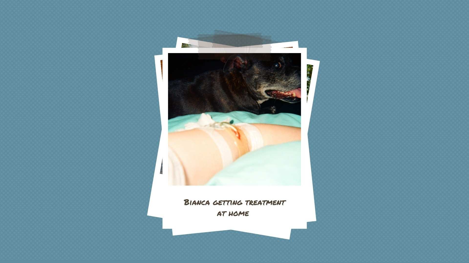 A young woman with a PICC line in her arm lays in bed with her dog watching on