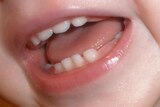 Baby teeth