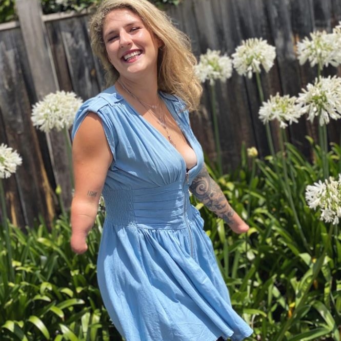 A woman with blonde hair and wearing a blue sundress smiles in the garden. She was born with no hands 