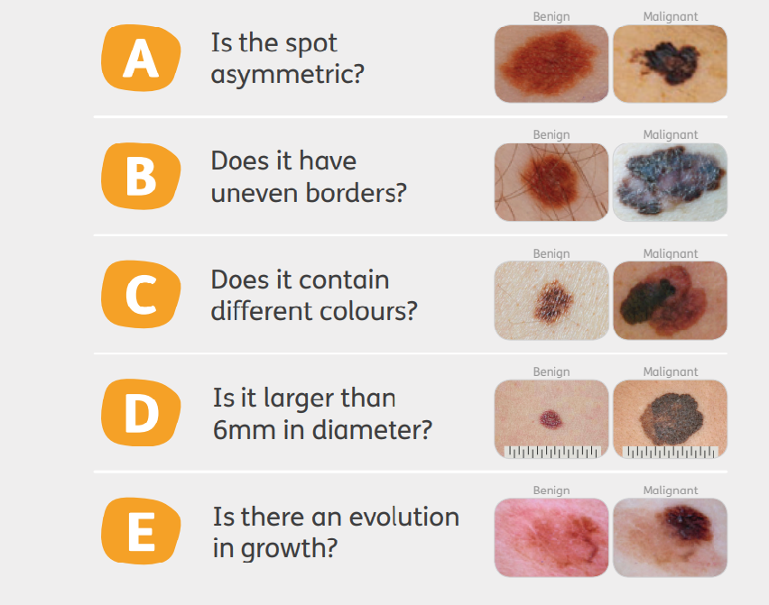 Pictures of different melanomas