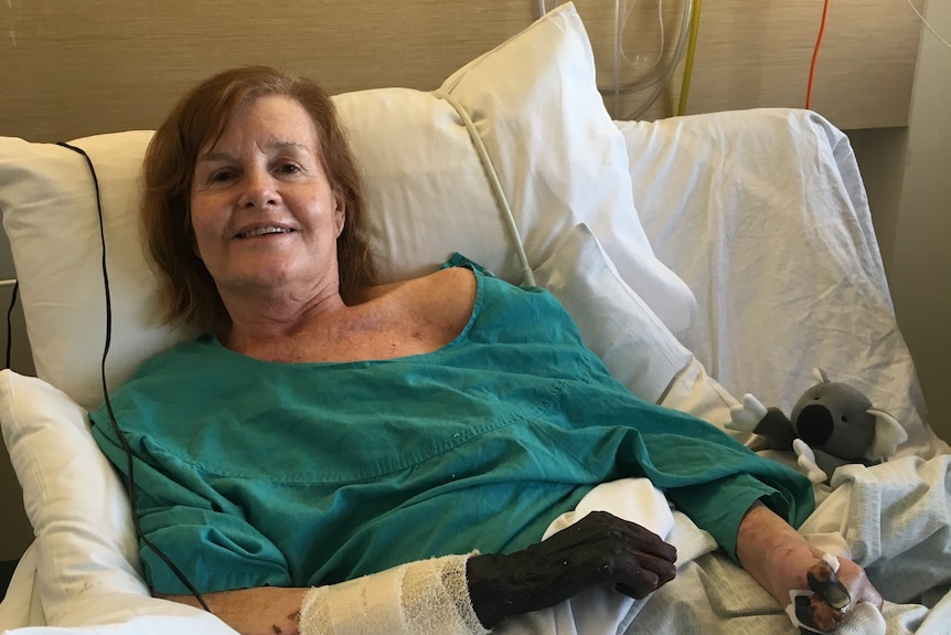 A woman in a hospital bed with black hands.