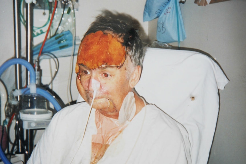 A man with facial injuries sits in a hospital bed