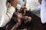 Pakistani paramedics treat a young injured bomb blast victim