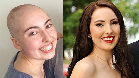 Two photos of Chelsea Stutchbury: one bald while undergoing chemo, the other a glamour shot from her high school formal