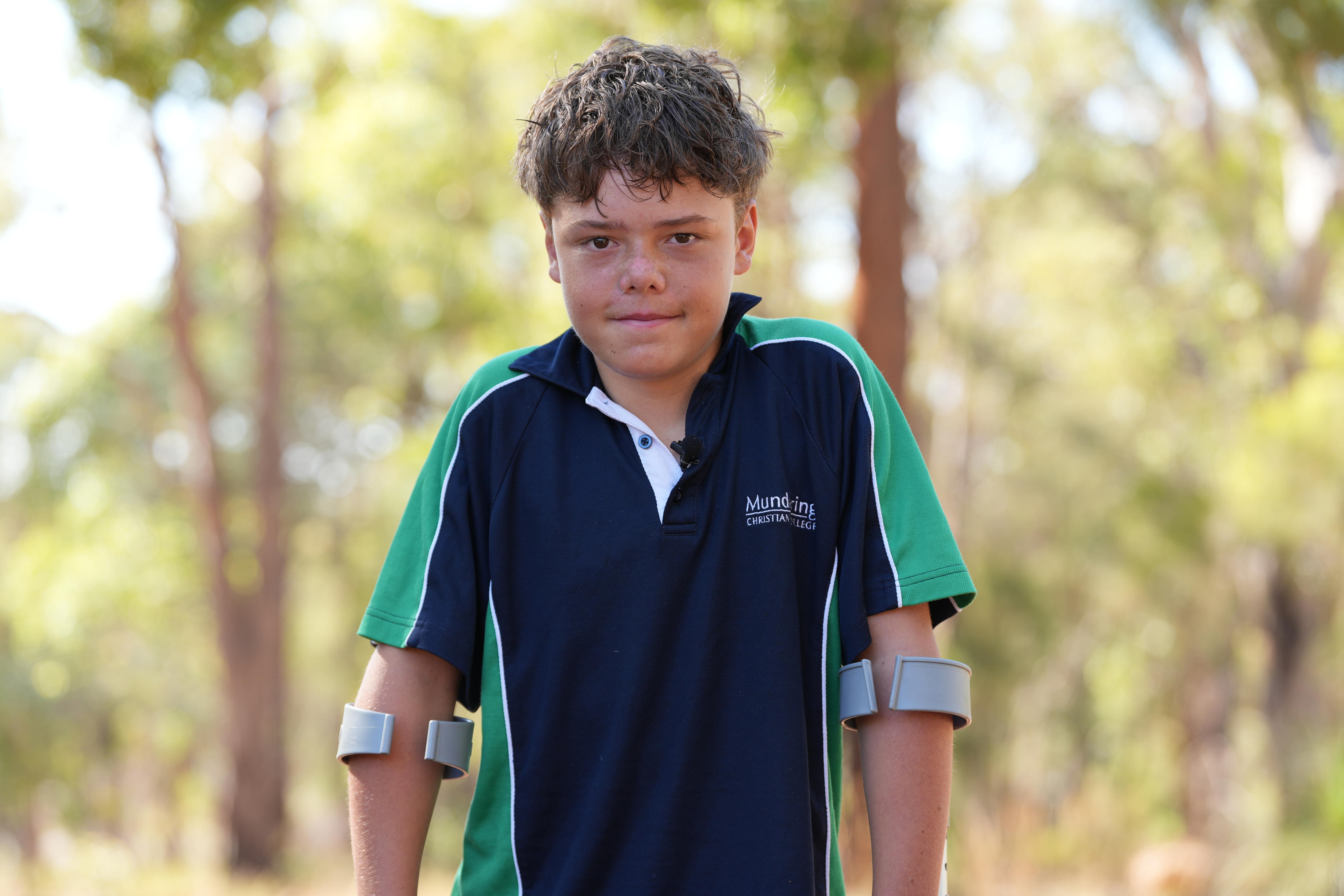 A boy with short brown hair, wearing his school uniform and holding crutches poses for a photo in front of bushland.
