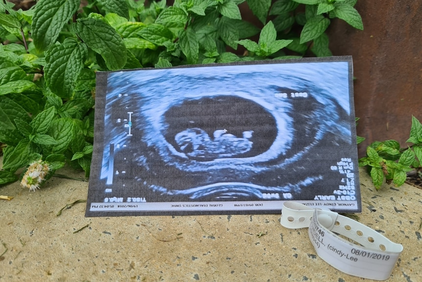 An ultrasound with a baby in it is seen in front of a mint bush, with a hospital bracelet on the bottom right hand side.