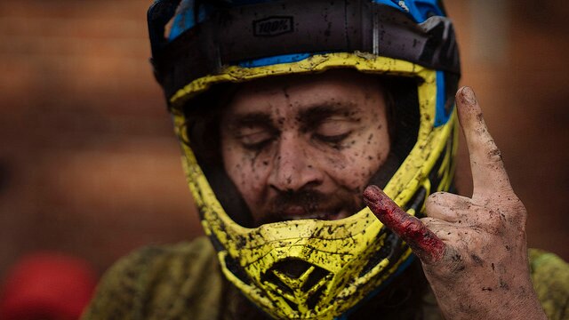 Rider shows injured finger at World Enduro Series