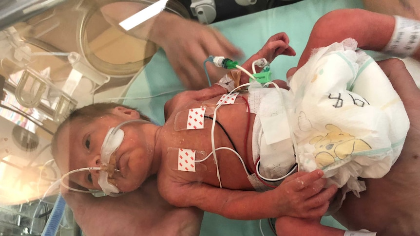 Premature baby with monitors and tubes attached being held inside a humidicrib.