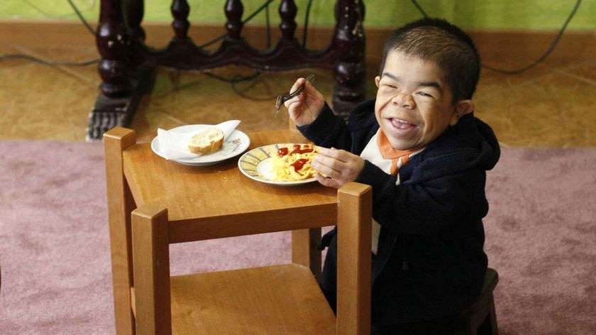 Nino Hernandez, who weighs only 10 kilograms, has not grown since he was two years old.