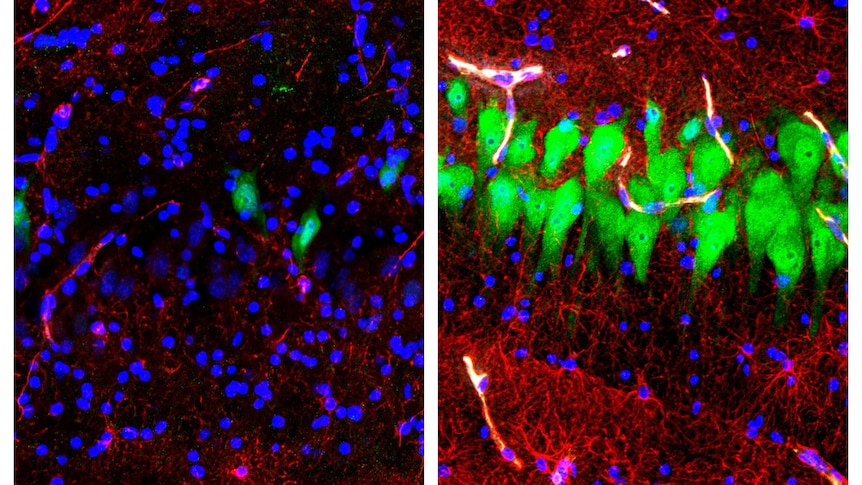 Stained microscope photos from a pig brain untreated for 10 hours after death (left).