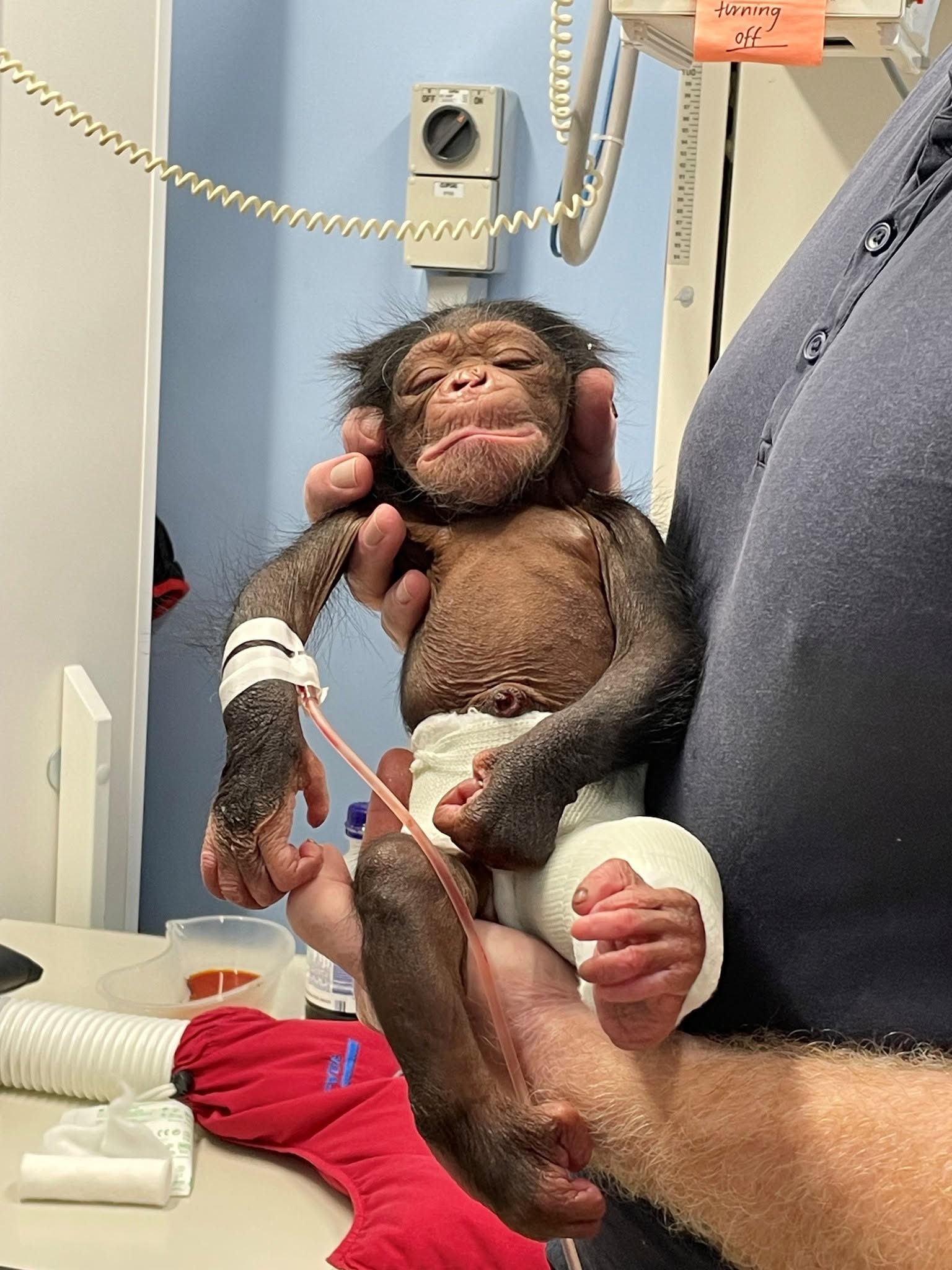 A newborn baby chimpanzee wearing bandages on one leg and an IV drip inserted in its arm is cradled by a human. 