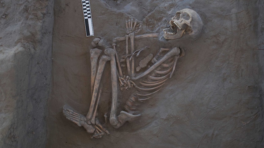 The skeleton of an aboriginal man who came to a grisly end, preserved in the banks of the Darling River in Northern NSW.