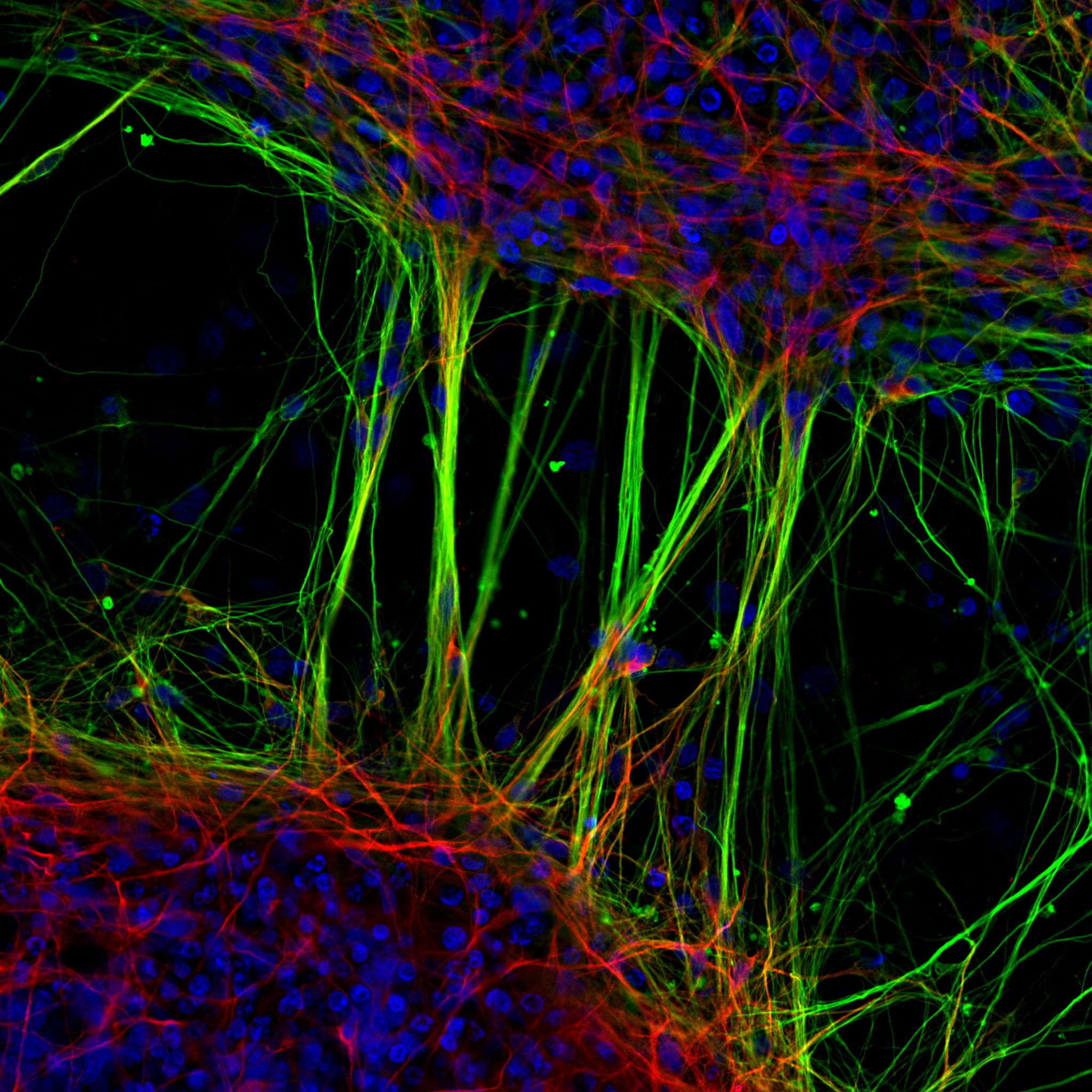 an extremely magnified image of human neurons shown as long thin fluoro green strands linking red web and blue dots