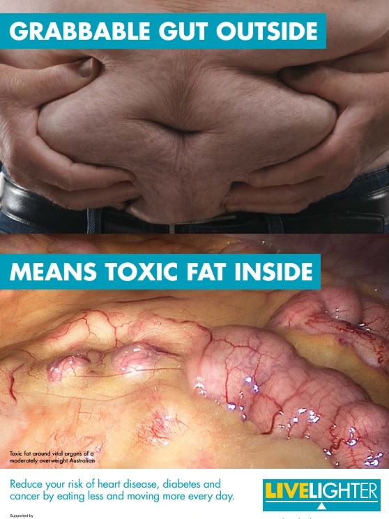 This toxic fat print advertisement is part of the ACT Government's LiveLighter campaign.