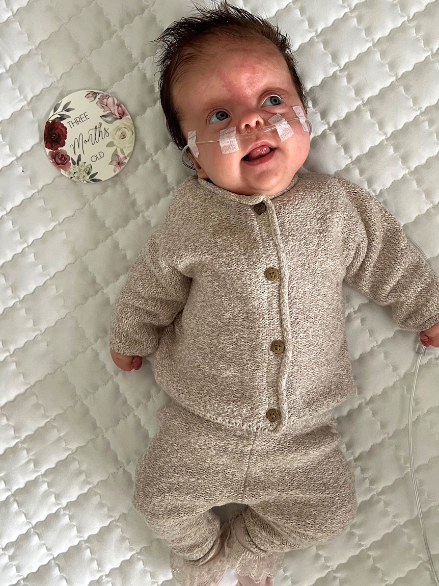 A baby with an airline in her nose lies on a white blanket