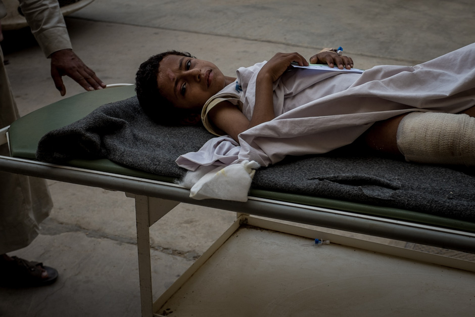 A boy with broken bones and burns awaits treatment.