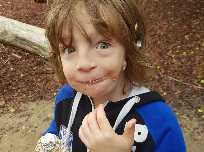 Boy with Goldenhar eating an ice cream and looking cheeky, funny at the camera