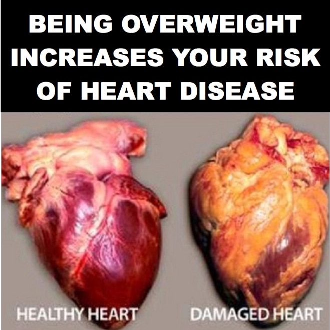 A picture of an unhealthy heart next to a healthy heart, with text 'being overweight increases your risk of heart disease'