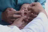 A baby getting a vaccine.